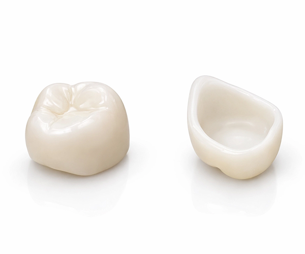 クラウン（被せ物）