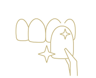 ラミネートベニア