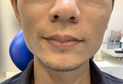 Before