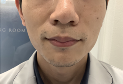After